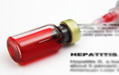 Hepatitis A